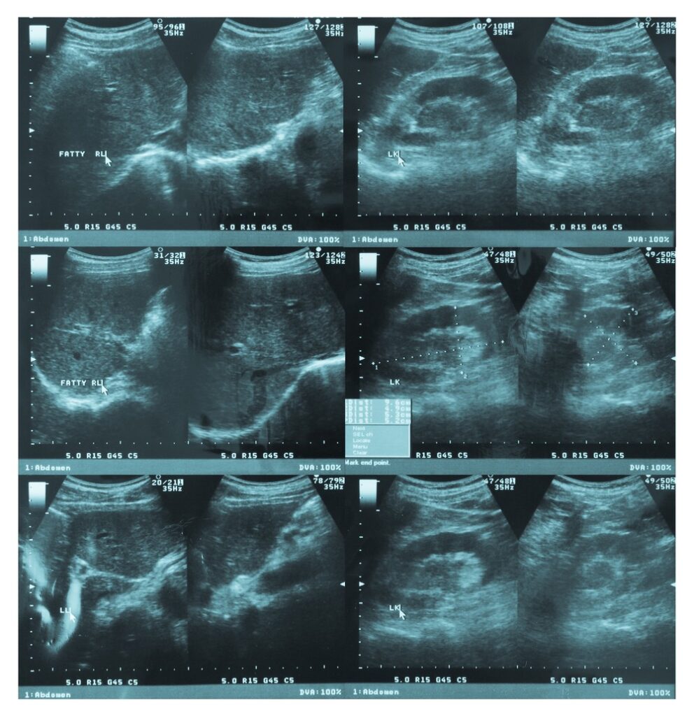 fertility pelvic scan