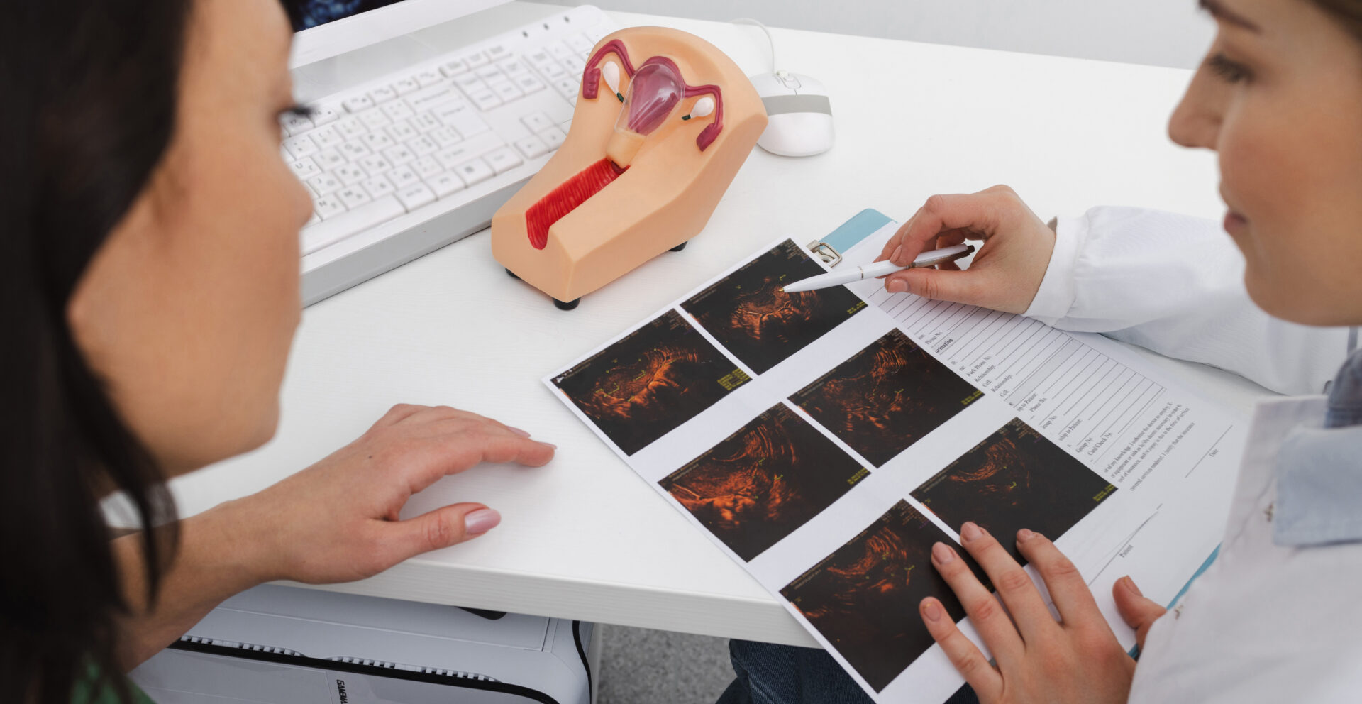 Follicular Tracking Scan